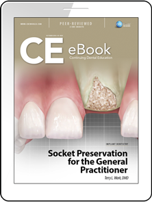 Socket Preservation for the General Practitioner eBook Thumbnail