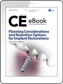 Planning Considerations and Retention Options for Implant Restorations eBook Thumbnail