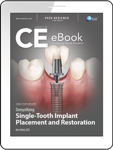 Demystifying Single-Tooth Implant Placement and Restoration eBook Thumbnail