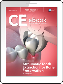 Atraumatic Tooth Extraction for Bone Preservation eBook Thumbnail