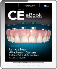 Using a New Attachment System for Fixed Full-Arch Restorations eBook Thumbnail