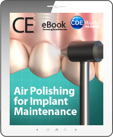 Air Polishing for Implant Maintenance eBook Thumbnail