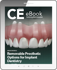 Removable Prosthetic Options for Implant Dentistry eBook Thumbnail