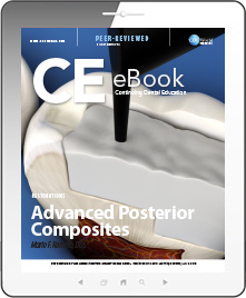 Advanced Posterior Composites eBook Thumbnail