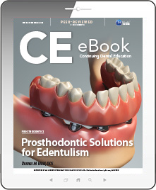 Prosthodontic Solutions for Edentulism eBook Thumbnail