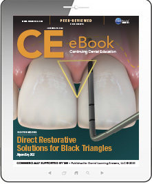 Direct Restorative Solutions for Black Triangles eBook Thumbnail