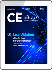 CO2 Laser Ablation of the Capillary Hemangioma of the Lip eBook Thumbnail