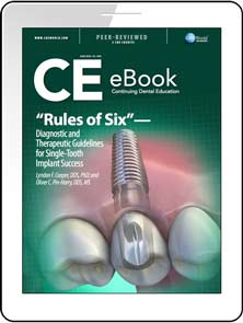 “Rules of Six”—Diagnostic and Therapeutic Guidelines for Single-Tooth Implant Success eBook Thumbnail
