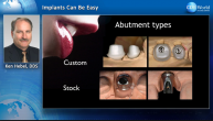 Implants Can Be Easy Webinar Thumbnail