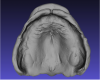 Fig 5. Scanned maxillary impression.