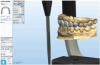 Fig 4. A digital articulator can be utilized to visualize functional and parafunctional interactions.