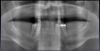 Fig 11. Panoramic radiograph revealed severe periodontal disease and terminal natural dentition.