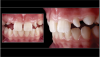 Fig 12. Specialist case documentation, such as for orthodontics, can utilize smartphone photography, such as this image taken with MDP.