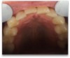 Fig 9. Case 2 intraoral photographs.