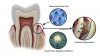 (1.) Fundamentals of periodontal regeneration.